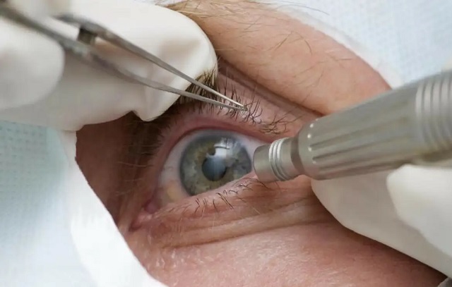 retina 