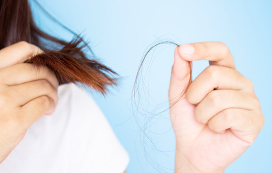 queda de cabelo